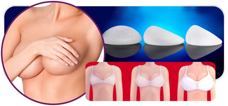 Qual a prótese de silicone ideal para o seu corpo?